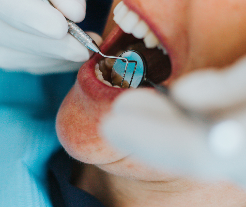 Estetica del sorriso